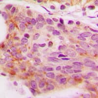 NFAT4 / NFATC3 Antibody (phospho-Ser165)