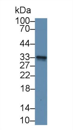 GSTM3 Antibody (aa8-223)