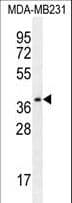 PRSS3 / Trypsin 3 Antibody (aa13-40)