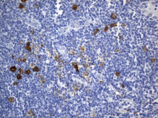 Monoclonal Mouse anti-Human CD30 Antibody (clone UMAB256, aa408-595, IHC, WB)
