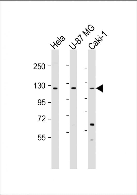Polyclonal Rabbit anti-Human STARD8 Antibody (aa220-255, WB)