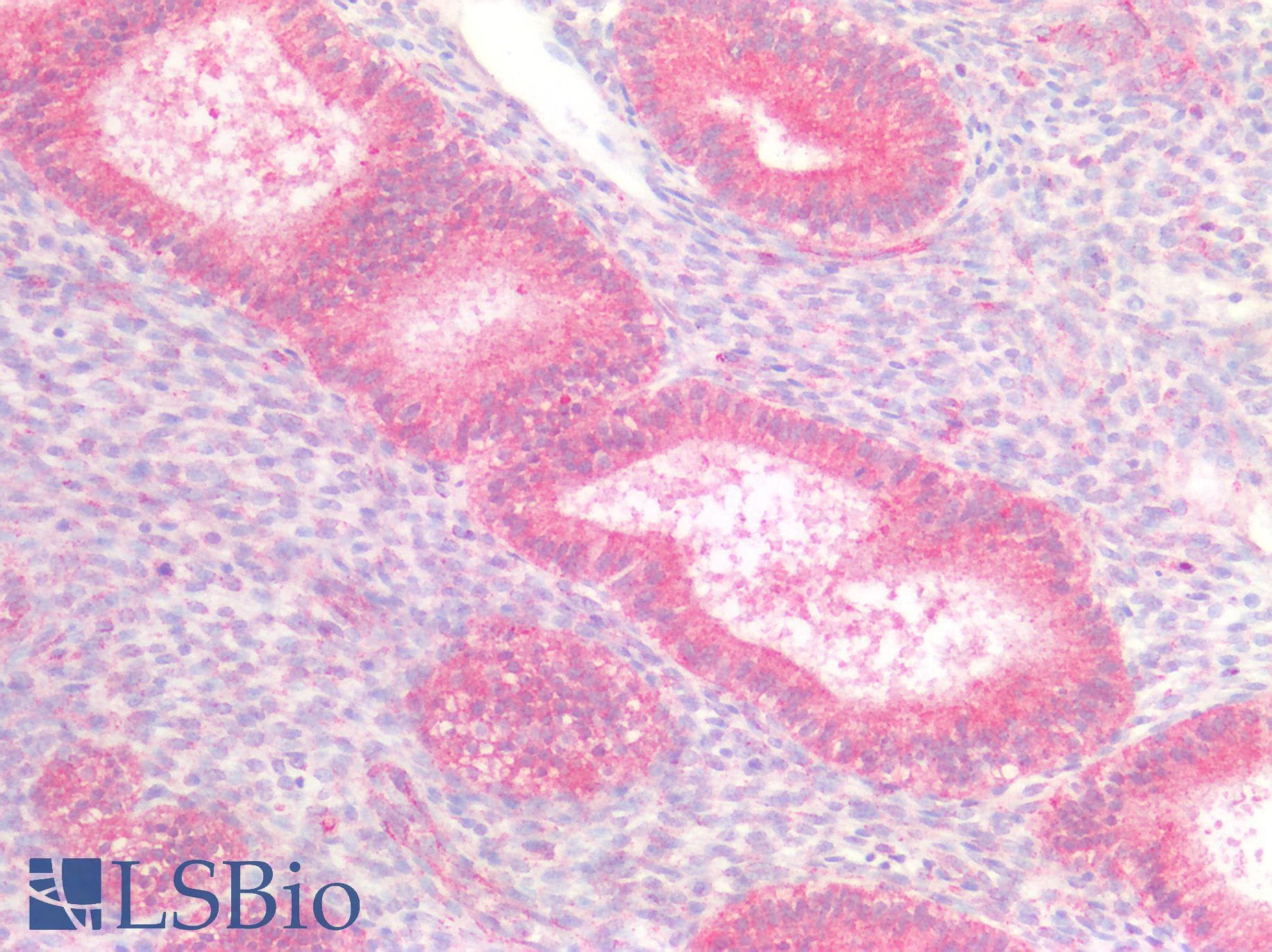 PathPlus™ Polyclonal Rabbit anti-Human CD95 / FAS Antibody (C-Terminus, IHC, WB)