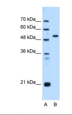 Polyclonal Rabbit anti-Human ST14 / Matriptase Antibody (C-terminal, IHC, WB)
