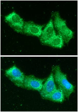 AIMP1 / EMAP II Antibody (clone AT6D10)