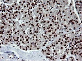 TRMT2A Antibody (clone OTI1H8, Carrier-free)