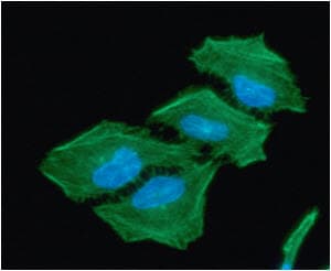 Monoclonal Mouse anti-Human ACAT2 Antibody (clone AT55D5, WB)