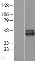 ALS2CR1 / NIF3L1 Protein (Over-Expression Lysate Myc-DDK (Flag))