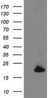 DSTN / Destrin Antibody (clone OTI1C5, Carrier-free)