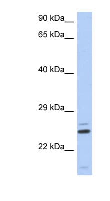 TTC9C Antibody (N-Terminus)