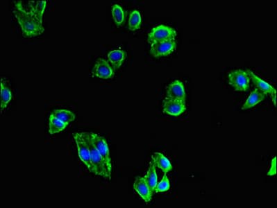MAPK10 / JNK3 Antibody