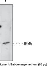 HPGDS Antibody