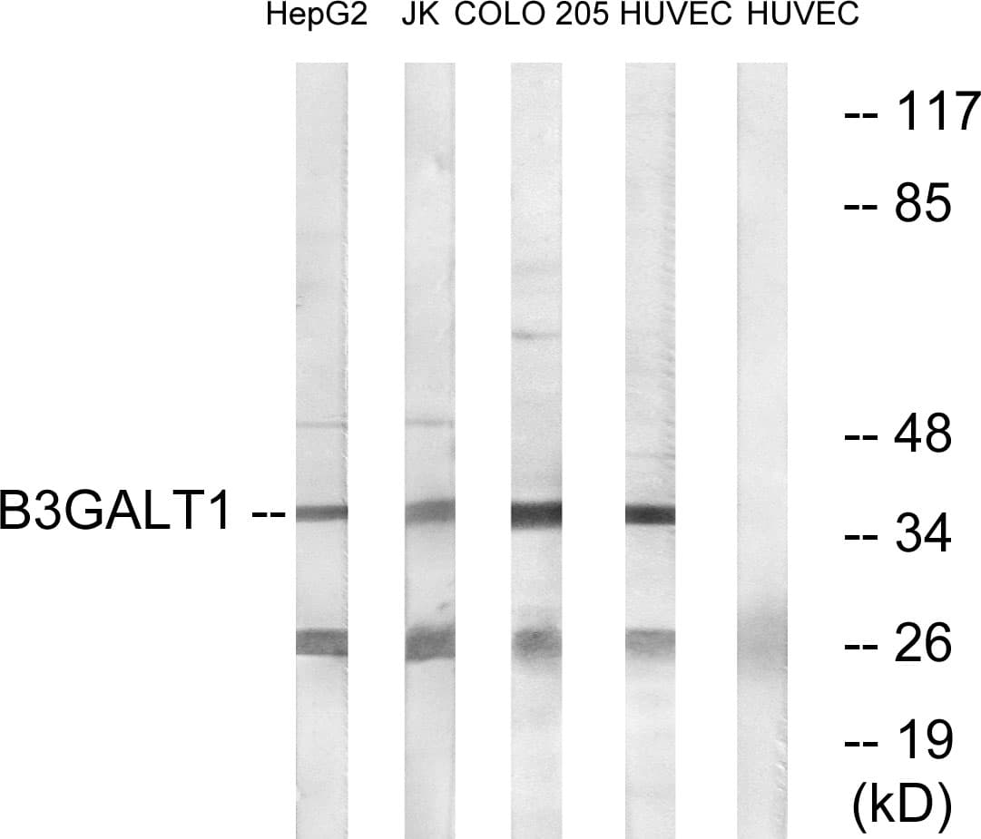 B3GALT1 Antibody (aa61-110)