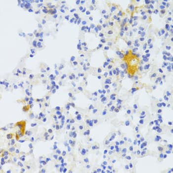 CD95 / FAS Antibody