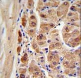 ALDH1A1 / ALDH1 Antibody
