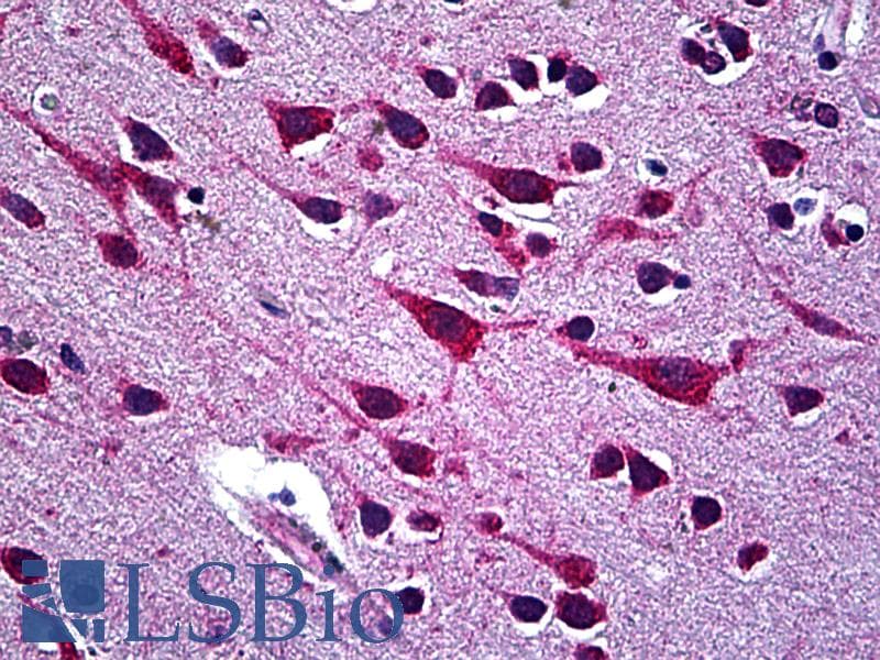 IHC-plus™ CCT5 / TCP1 Epsilon Antibody (clone 4E5-4B1)