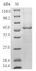 Human CHMP1B Protein (Recombinant GST, N-terminus)