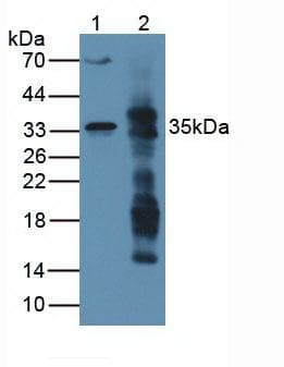 ARG1 / Arginase 1 Antibody (aa1-323)