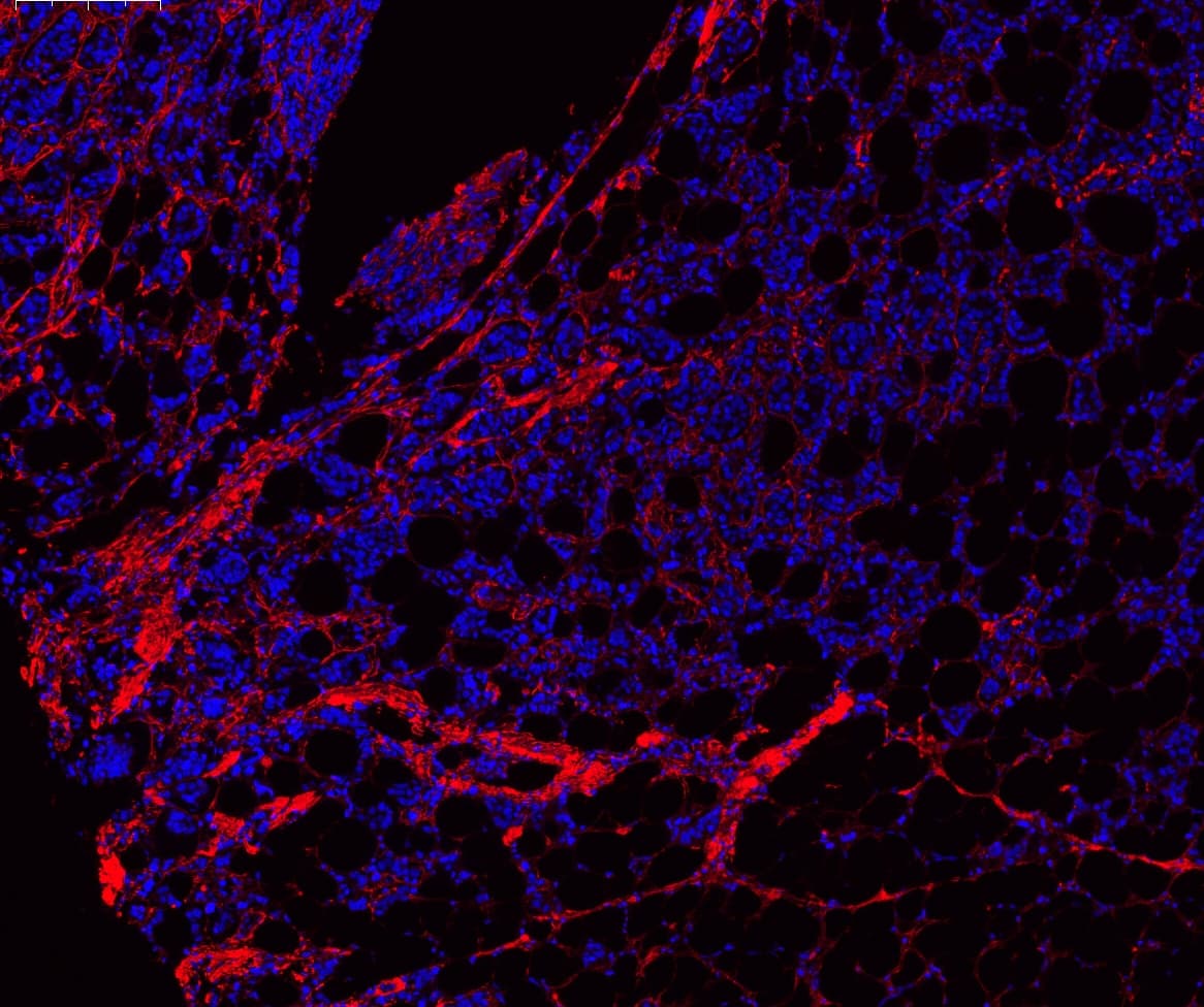 COL1A1 / Collagen I Alpha 1 Antibody (aa1192-1207)