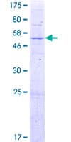 Human TRMT10C / RG9MTD1 Protein (Recombinant GST)