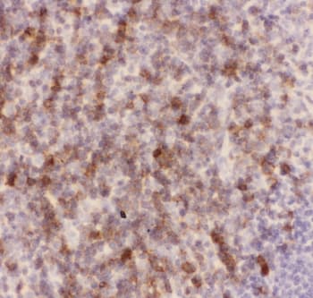 SPN / CD43 Antibody