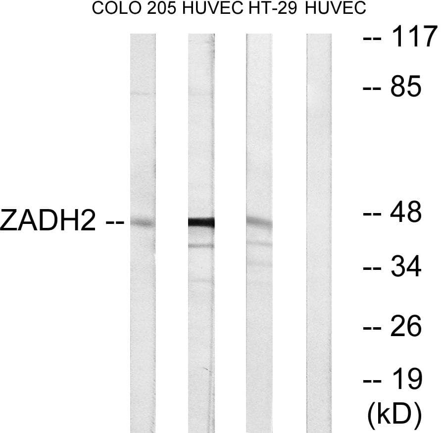 ZADH2 Antibody