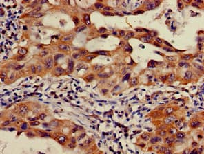 Polyclonal Rabbit anti-Human OS9 Antibody (IHC, IF, WB)