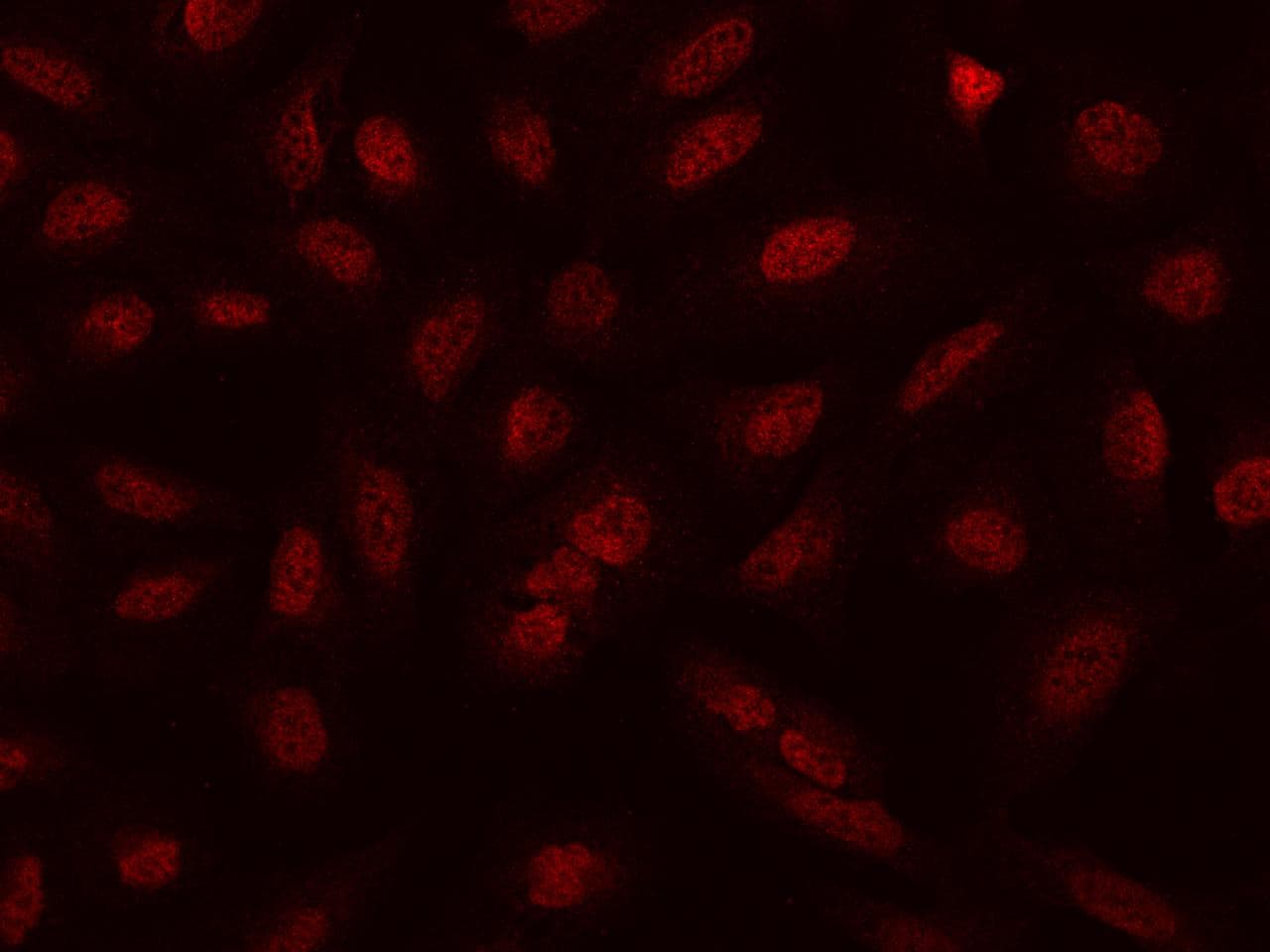 NCAPH / CAP-H Antibody