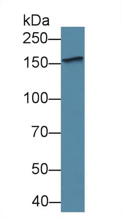 KDR / VEGFR2 / FLK1 Antibody (aa8-290, PE)