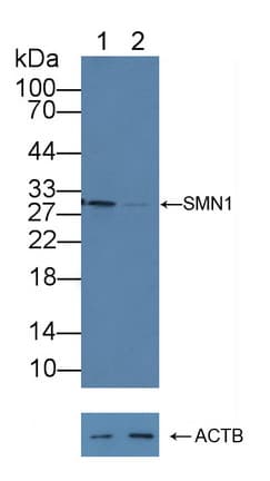Polyclonal Rabbit anti-Human SMN1 Antibody (aa2-294, WB)