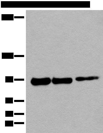 PIBF1 / PIBF Antibody