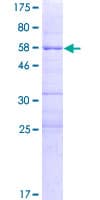 Human MMS21 / NSMCE2 Protein (Recombinant GST)