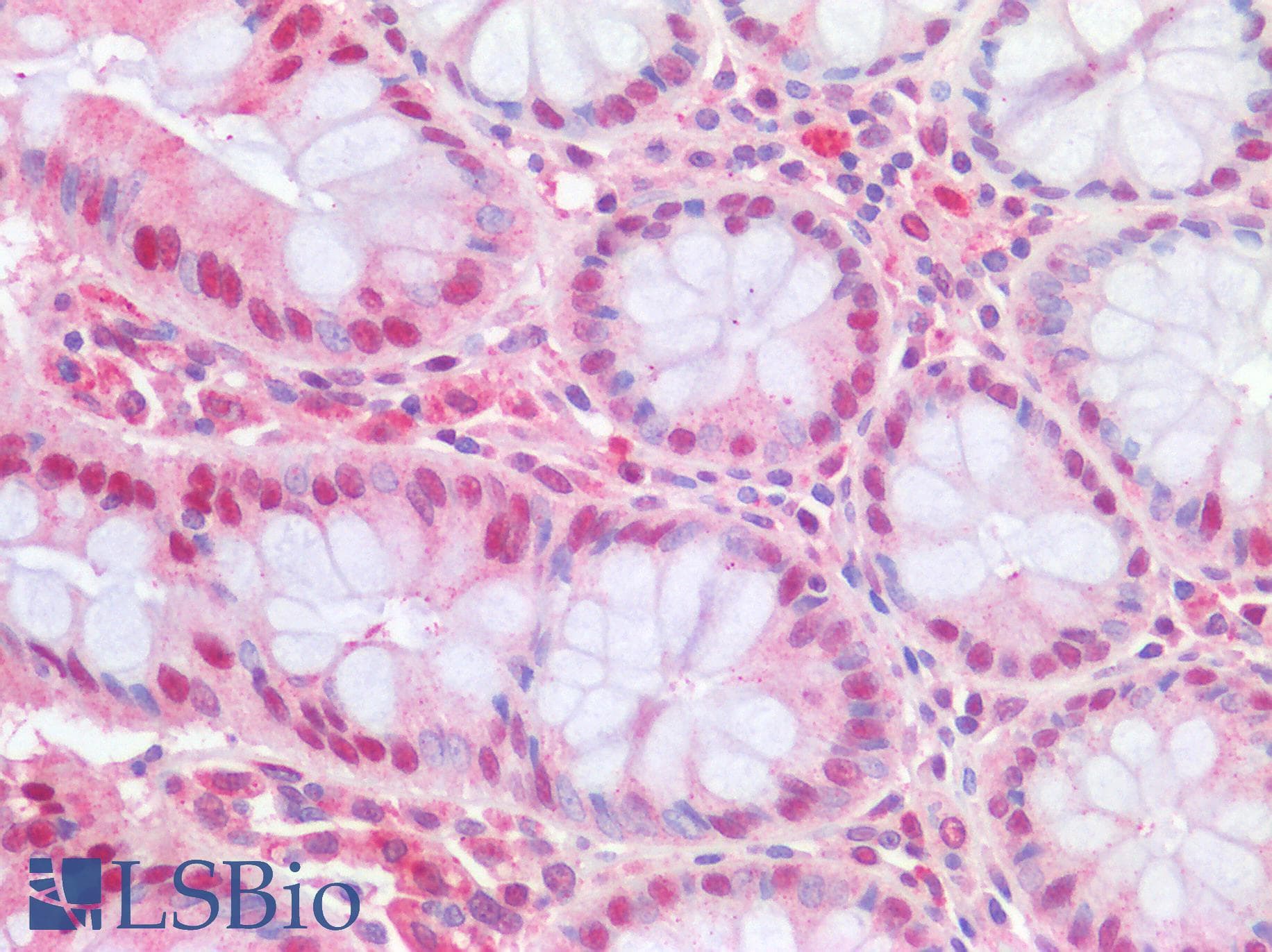 IHC-plus™ SQSTM1 Antibody