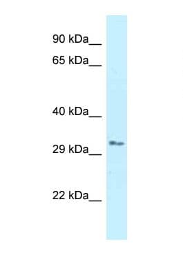 Polyclonal Rabbit anti-Human RNF167 Antibody (C-Terminus, WB)