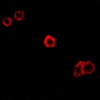 Polyclonal Rabbit anti-Human SPAM1 / PH20 Antibody (IF, WB)