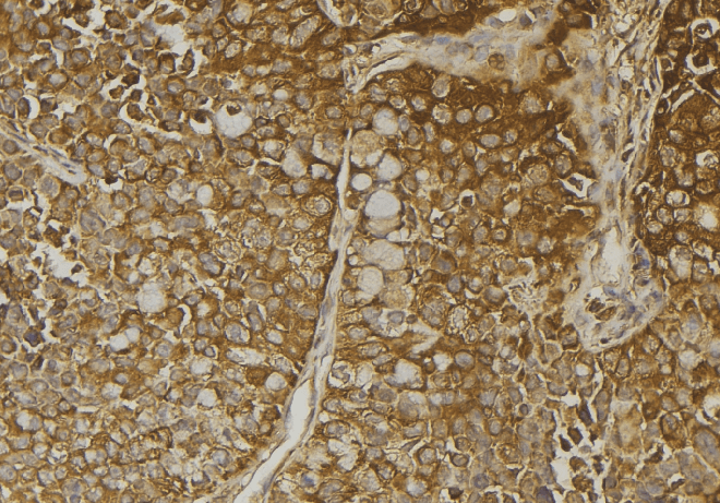 SULT4A1 / Sulfotransferase 4A1 Antibody