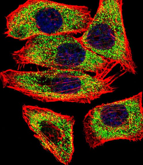 Polyclonal Rabbit anti-Human TGM2 / Transglutaminase 2 Antibody (Lys444, IHC, IF, WB)