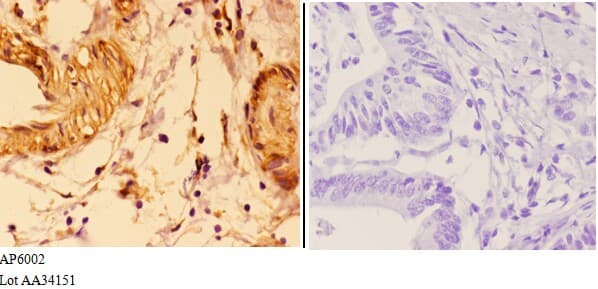 VWF / Von Willebrand Factor Antibody