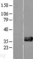 NUDT18 Protein (Over-Expression Lysate Myc-DDK (Flag))