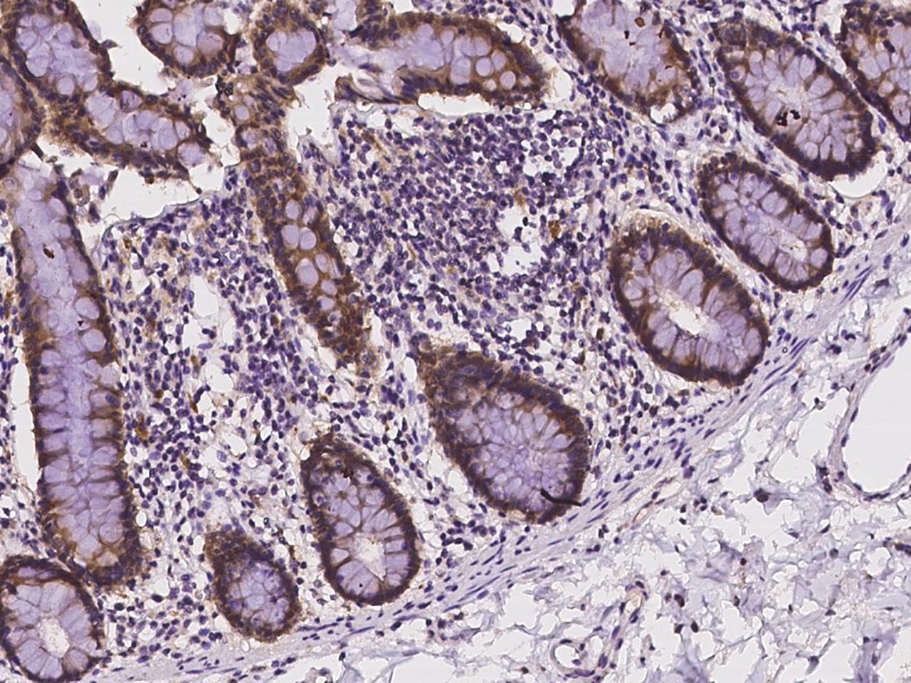 Polyclonal Rabbit anti-Human STARD10 Antibody (IHC)