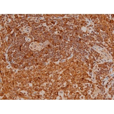 Polyclonal Rabbit anti-Human FLNA / Filamin A Antibody (phospho-Ser2152, IHC, IF, WB)