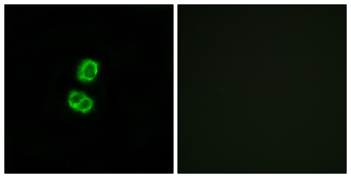 FGF22 Antibody (aa71-120)