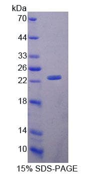 Rat ABCA9 Protein (Recombinant His-T7, N-terminus)