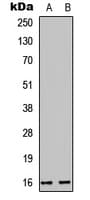 CST6 / Cystatin E/M Antibody (Internal)