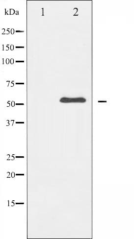 ABL1 / c-ABL Antibody