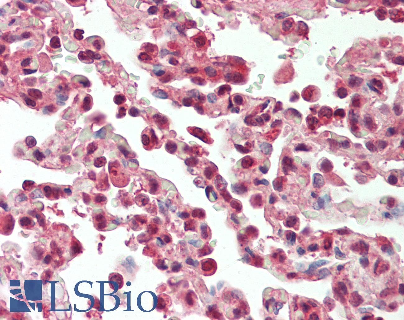 PathPlus™ SF1 Antibody (aa65-114)