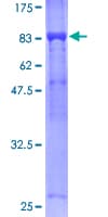 Human APC6 / CDC16 Protein (Recombinant GST)
