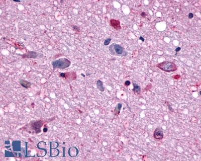 PathPlus™ Polyclonal Rabbit anti-Human MCHR1 Antibody (N-Terminus, IHC)