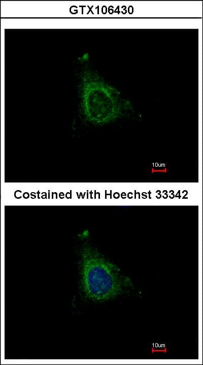 Polyclonal Rabbit anti-Human AKAP10 Antibody (aa600-662, IHC)