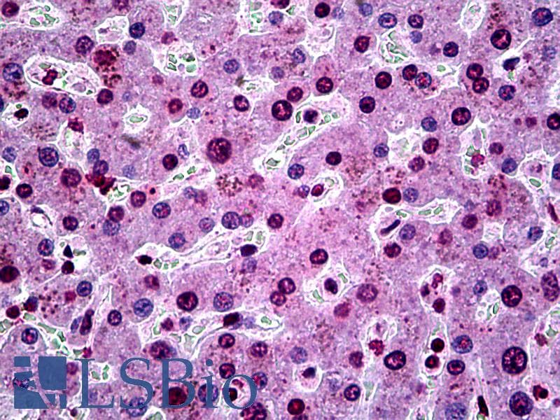 IHC-plus™ SGK1 / SGK Antibody (clone 3C4)
