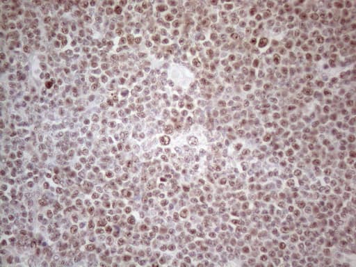 MLH1 Antibody (aa299-527, clone UMAB191)